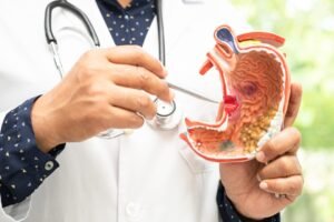 Exploring Gastrointestinal Discomfort